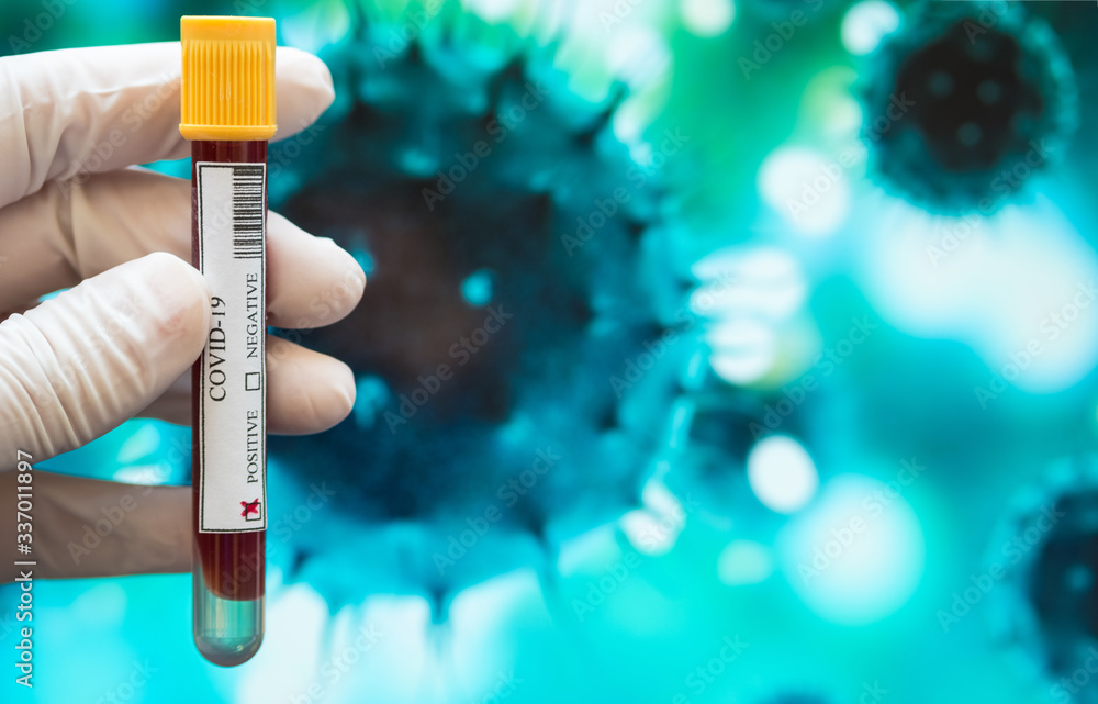 Close-up of a hand with white glove holding a sample of blood test tube which is positive for Covid-19 on blurred Coronavirus depiction background. Positive coronavirus test tube. Close-up of a hand with white glove holding a sample of blood test tube which is positive for Covid-19 on blurred Coronavirus depiction background. Positive coronavirus test tube.