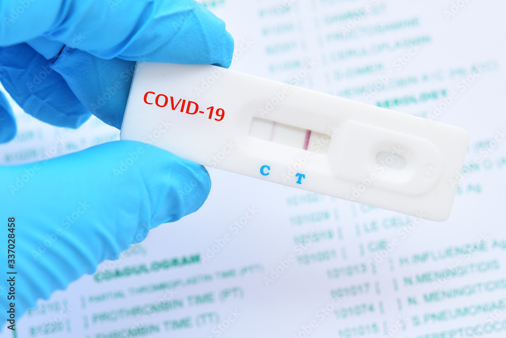 Positive test result by using rapid test device for COVID-19 virus Positive test result by using rapid test device for COVID-19 virus