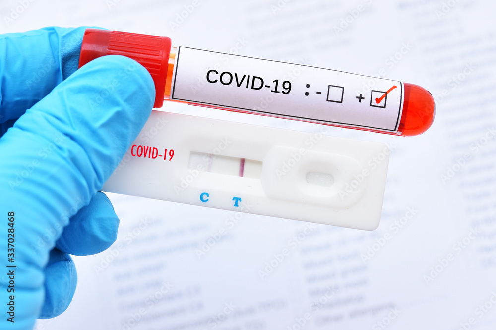 Fototapeta premium Positive test result by using rapid test device for COVID-19 virus