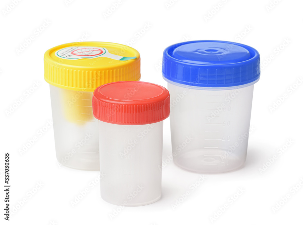 Plastic specimen medical test containers Plastic specimen medical test containers