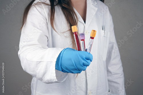 Doctor holding three corona virus blood tubes