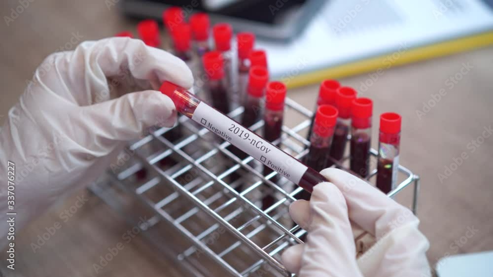 Biologist hands pick up a blood test tube has Covid-19 label, 2019 nCov concept. Biologist hands pick up a blood test tube has Covid-19 label, 2019 nCov concept.