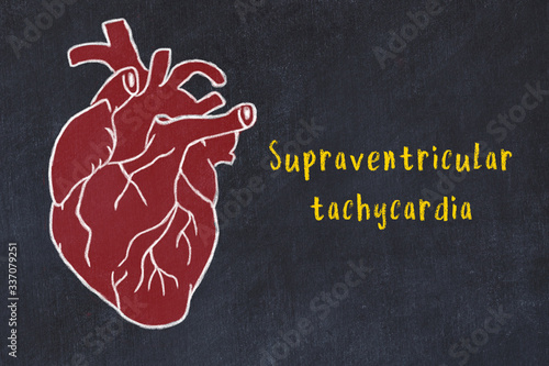 Принти на полотні Concept of learning cardiovascular system