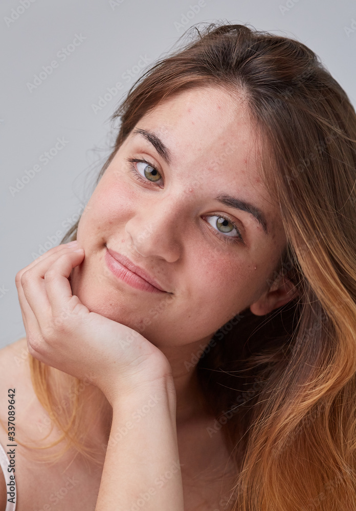 Sensitive skin portrait Sensitive skin portrait