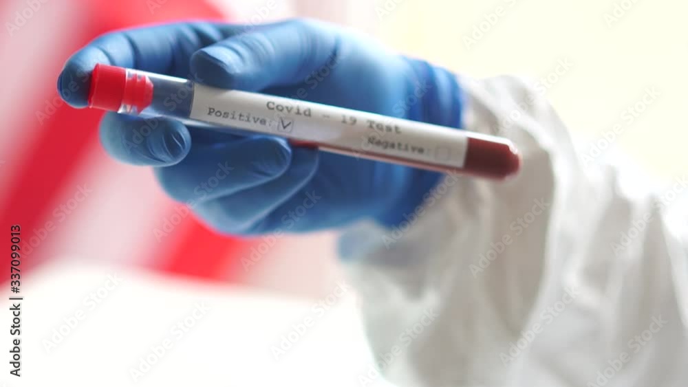 Close-up portrait of a test tube with blood plasma in the hands of a microbiologist in protective blue gloves, the study of the virus in the laboratory. Positive test for coronovirus covid-19 Close-up portrait of a test tube with blood plasma in the hands of a microbiologist in protective blue gloves, the study of the virus in the laboratory. Positive test for coronovirus covid-19