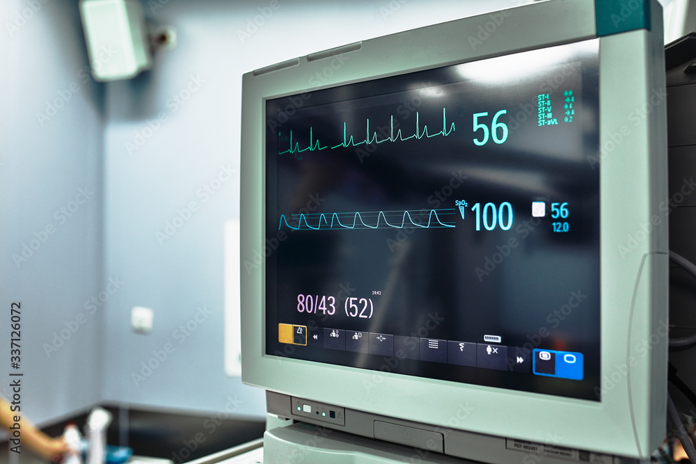 Clinical trial results on a monitor screen. Medical equipment. Monitor  vital indicators. Heart rate, mechanical ventilation. Modern medicine.  Stock-Foto | Adobe Stock
