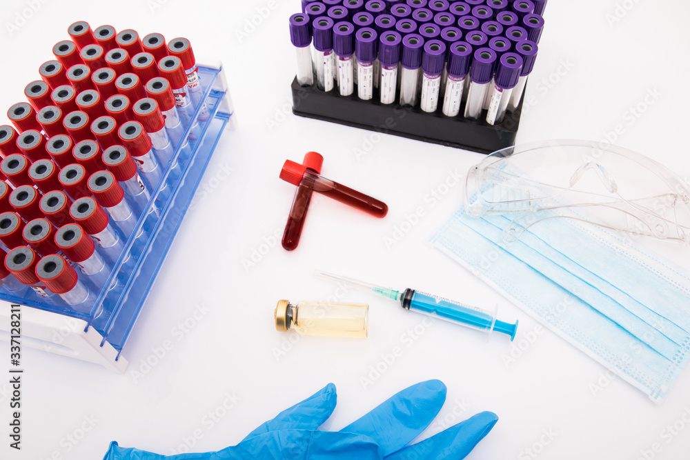 Coronavirus blood test concept. Test tube with Coronavirus positive blood on laboratory desk. Blood test result.