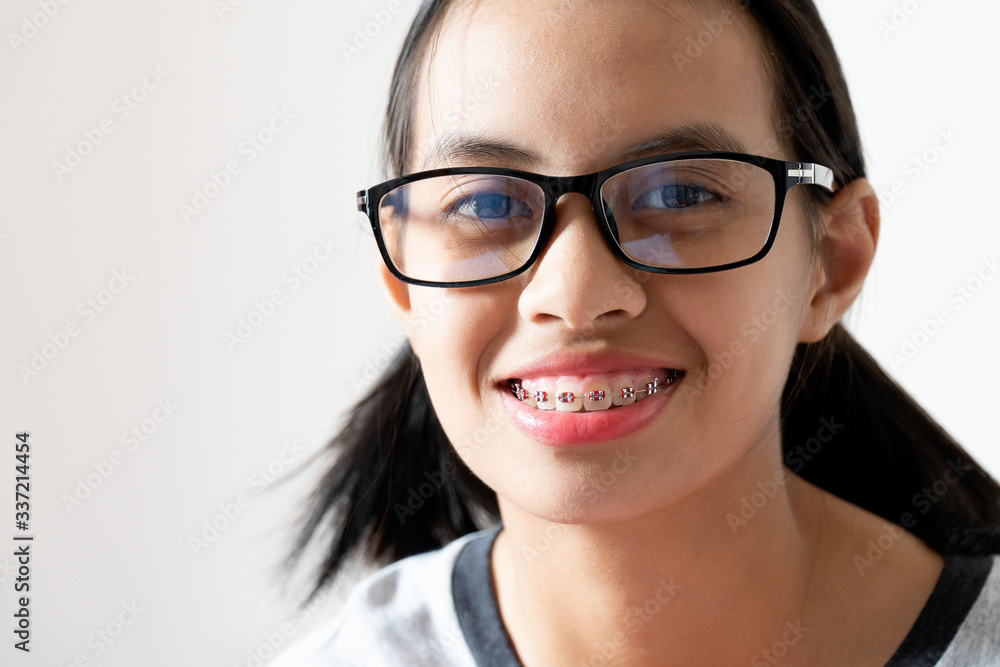 Dental Brace Girl Smiling and Looking to Camera, She Feel Happy and Have Good Attitude with Dentist. Motivate Kids not Fear When they have to go to Dental Clinic. Dental Brace Girl Smiling and Looking to Camera, She Feel Happy and Have Good Attitude with Dentist. Motivate Kids not Fear When they have to go to Dental Clinic.
