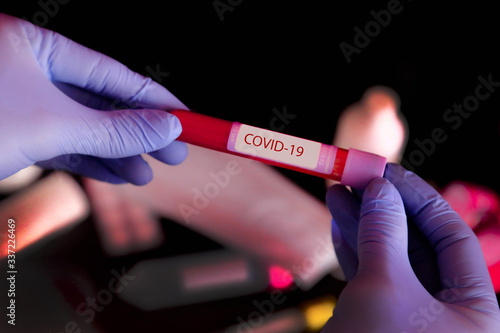 coronovirus test. blood test in the laboratory
