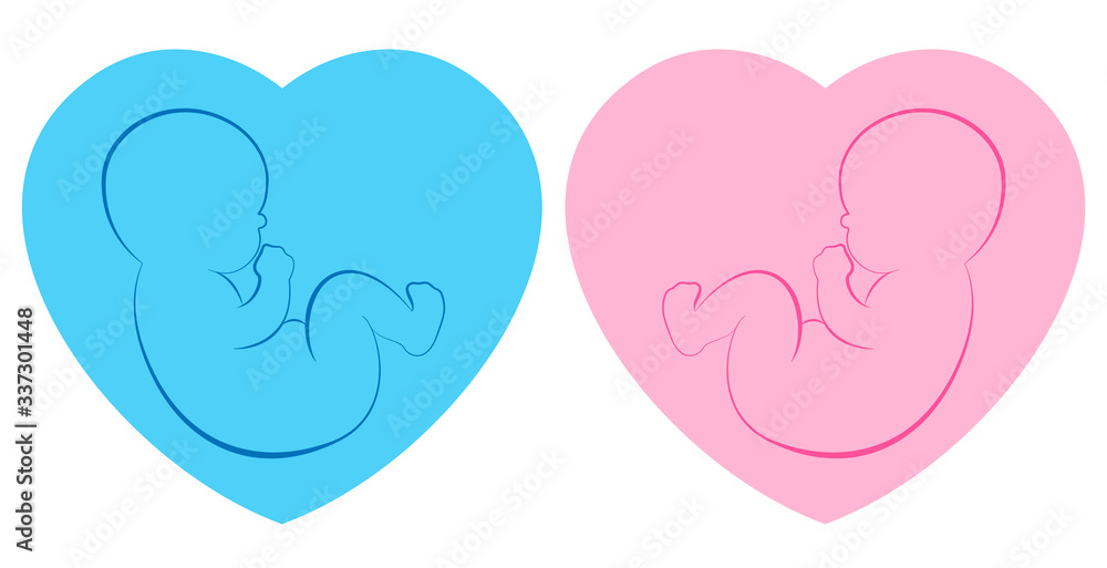 Twins pictogram. Baby boy and baby girl on blue and pink heart framed background. Isolated outline vector illustration.
Twins pictogram. Baby boy and baby girl on blue and pink heart framed background. Isolated outline vector illustration.