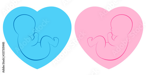 Twins pictogram. Baby boy and baby girl on blue and pink heart framed background. Isolated outline vector illustration.
