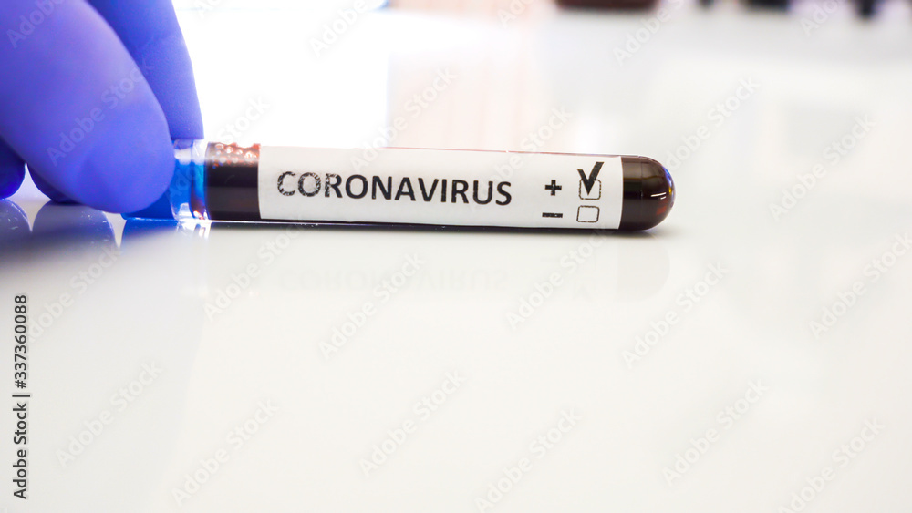 Obraz premium A small kit with blood inside for COVID-19 coronavirus