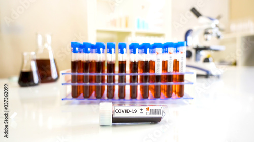 The small blood sample kit for coronavirus