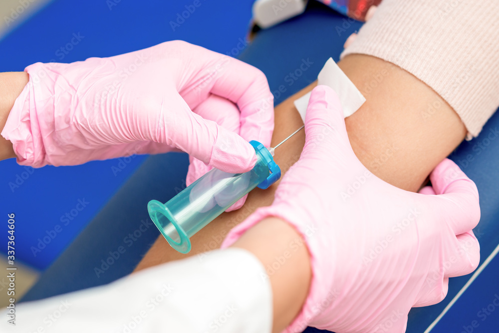 Nurse takes blood sampling introducing a needle into a vein of woman's arm. Nurse takes blood sampling introducing a needle into a vein of woman's arm.