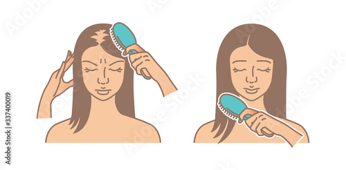 Hair loss problem. Hair loss woman. Hair care and treatment vector illustration
