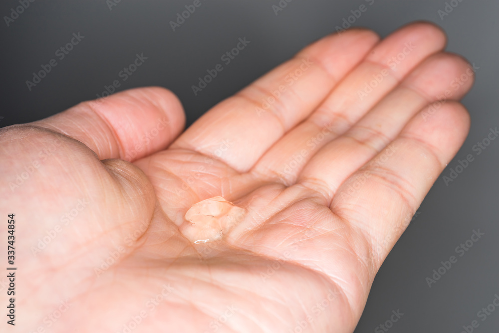 Close-up of antibacterial hand gel on the palm of a hand. To prevent and kill germs, virus and bacteria. Coronavirus, Covis-19, Health and protection. Close-up of antibacterial hand gel on the palm of a hand. To prevent and kill germs, virus and bacteria. Coronavirus, Covis-19, Health and protection.