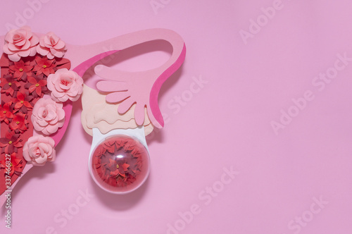 Foto The creative concept of endometrioid ovarian cyst