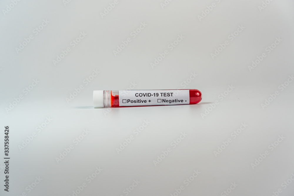 Studio shot of Covid-19 blood test sample on white background Studio shot of Covid-19 blood test sample on white background