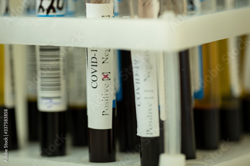 Fototapeta Naklejka Na Ścianę i Meble -  Close up rack with lab tubes of biological samples, coronavirus positive results