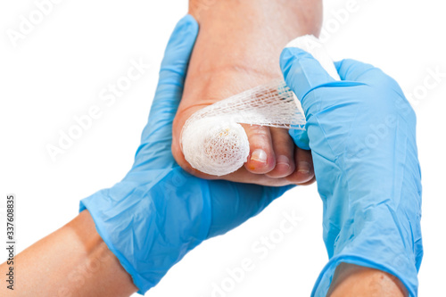 Billede på lærred Bandaged injured toenail