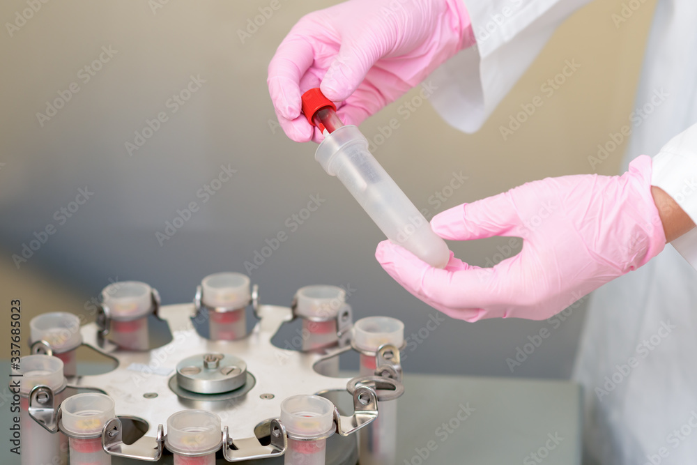 Obraz premium Test tube of blood in hands of nurse while analysis by coronavirus.