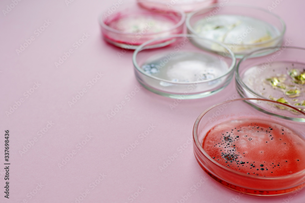 Viruses and bacteria in a Petri dish, various analyses in the laboratory. Virology and virus research, concept. Viruses and bacteria in a Petri dish, various analyses in the laboratory. Virology and virus research, concept.