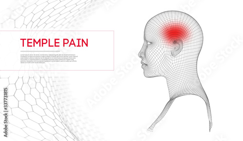 Beautiful woman suffering from headache in temples. Medical vector background.