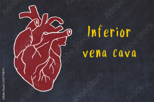 Chalk sketch of human heart on black desc and inscription Inferior vena cava photo