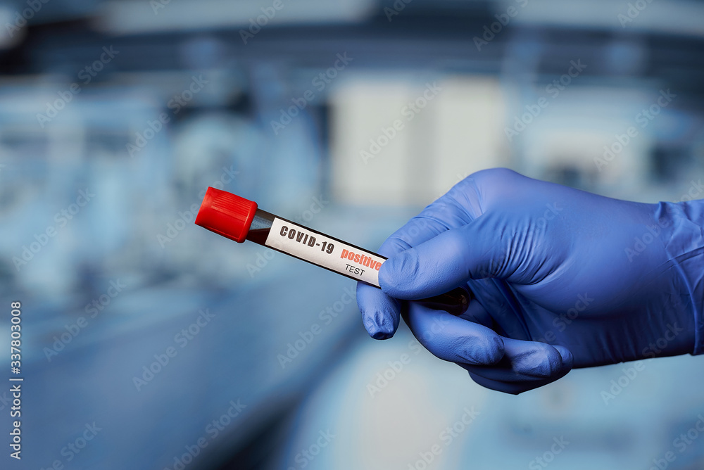 Naklejka premium A hand of a doctor in a disposable medical glove holding a positive coronavirus (COVID-19) blood sample in the laboratory.