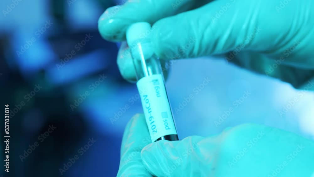 Laboratory tubes with blood and virus. Close-up of scientific lab in hospital. Epidemic disease, healthcare, vaccine research and coronavirus 2019-ncov test. Laboratory tubes with blood and virus. Close-up of scientific lab in hospital. Epidemic disease, healthcare, vaccine research and coronavirus 2019-ncov test.
