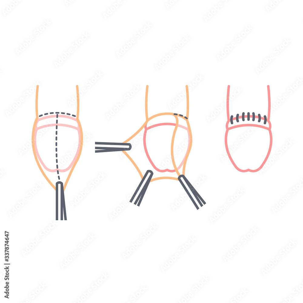 circumcision line icon, vector illustration circumcision line icon, vector illustration