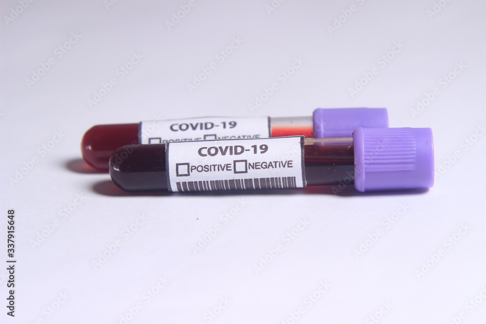Close Up Photo, Simple Conceptual Hand Draw Sketch Vector, Glass Blood Covid-19 Test tube, without result Close Up Photo, Simple Conceptual Hand Draw Sketch Vector, Glass Blood Covid-19 Test tube, without result
