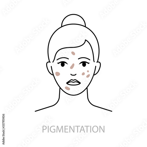 Skin pigmentation disorders vector icon line style