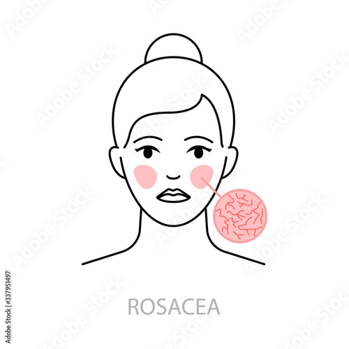 Rosacea vector icon line style