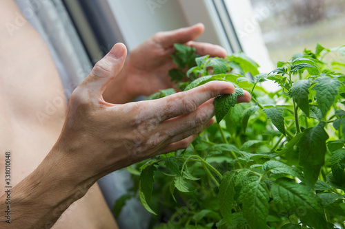 hands in vitiligo touch plants