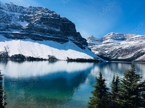 カナダ・バンフのルイース湖