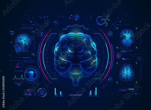 brainScan2