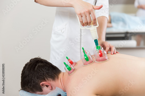 Woman hands masseur puts banks on the back of a man. Vacuum massage. The procedure for recovery in the clinic.