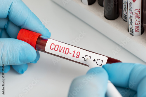 Doctor holding blood sample, putting check mark near negative symbol. Concept of test on Covid-19 with negative result