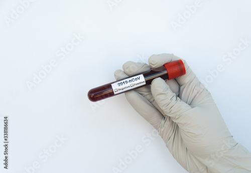 Hand in white medical gloves holding test tube with Coronavirus blood test. Isolated on white background