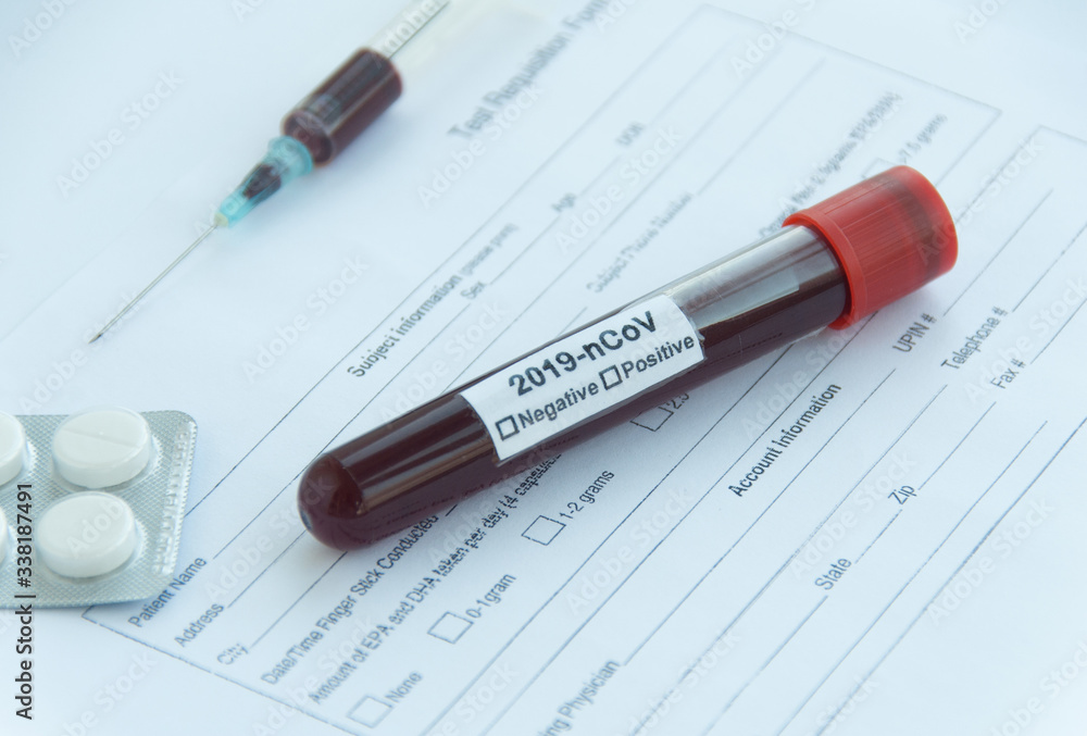 Medical form of a coronavirus test, a syringe with blood, and pills on a white background in the hospital. Close up Medical form of a coronavirus test, a syringe with blood, and pills on a white background in the hospital. Close up