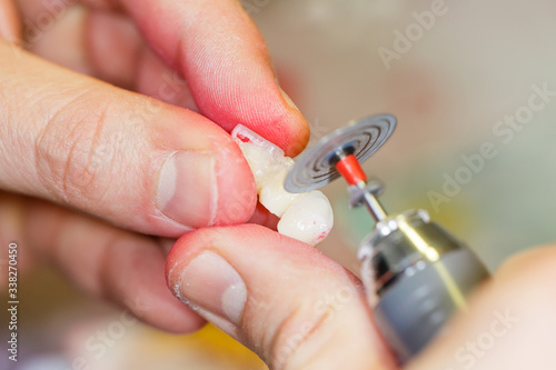 dental technician working on a tooth crown