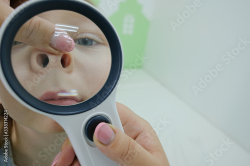 child in a children's clinic at the pediatrician with a magnifier. Close-up doctor's hand with modern otoscope examining girl's nose . Children's health and disease prevention
