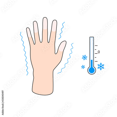 Frostbite. Hand with frostbite symptoms. effect of cold on human fingers. Vector illustration