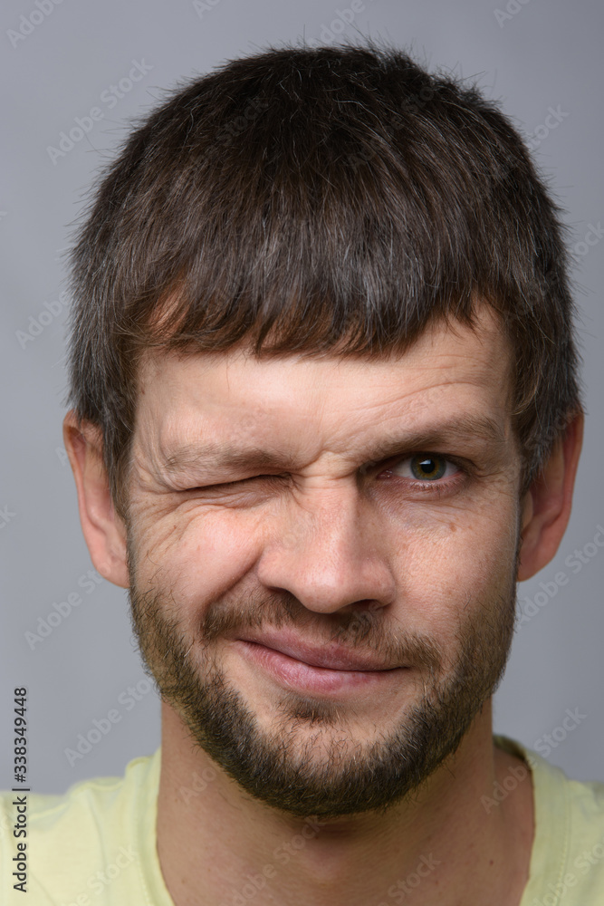 Close-up portrait of a man covering one eye, European appearance Close-up portrait of a man covering one eye, European appearance