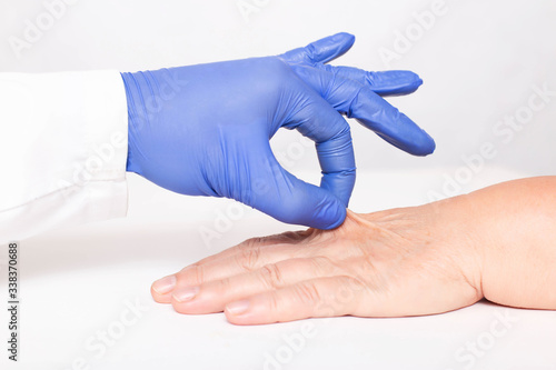 A cosmetologist doctor examines the dry and wrinkled skin on the hand of an elderly woman. The concept of rejuvenation of the skin on the hands, procedures for elasticity and hydration