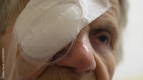 Slika na platnu Old woman with protective eye patch after cataract surgery.