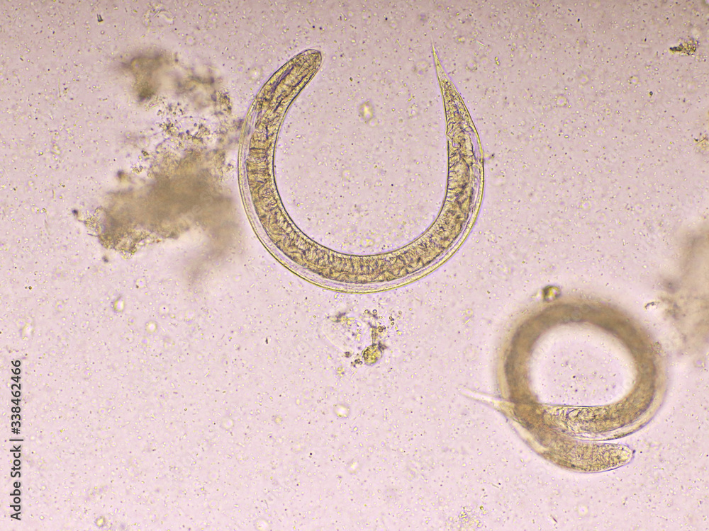 Strongyloides stercoralis or threadworm in human stool, analyze by ...