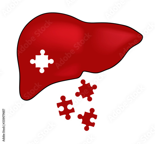 illustration of the liver. liver disease. vector illustration.