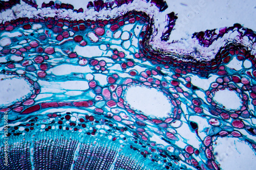 Microscopic image of Pine Stem (cross-section) photo